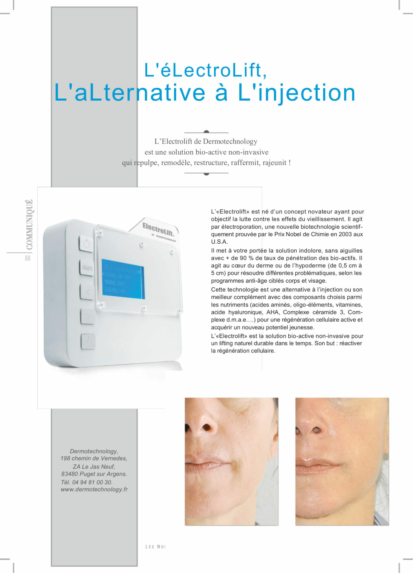 L'alternation à l'injection